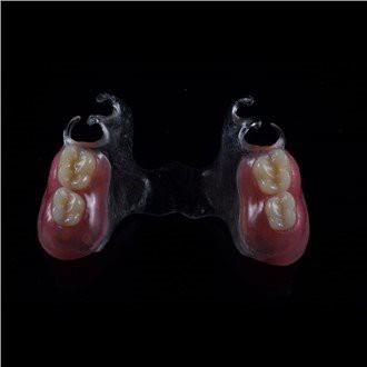 Uklonjiva djelomična akrilna proteza