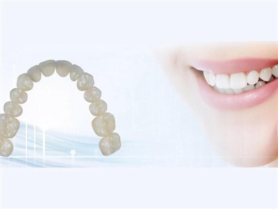 Outsourcing dentalnog laboratorija: prednosti, nedostaci i ključna razmatranja