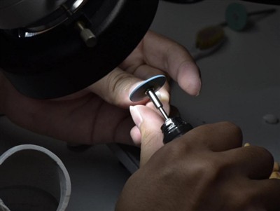 Koliko dugo traju PFM krunice? Prosječni životni vijek, čimbenici i savjeti z...