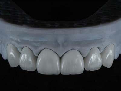 Kako angažirati tehničare zubnog laboratorija za rad u inozemstvu: opsežan vodič